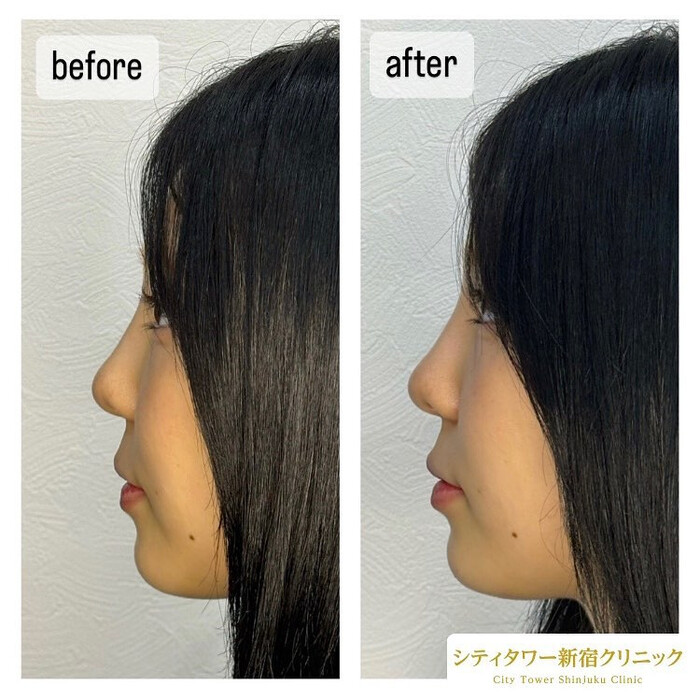 画像446